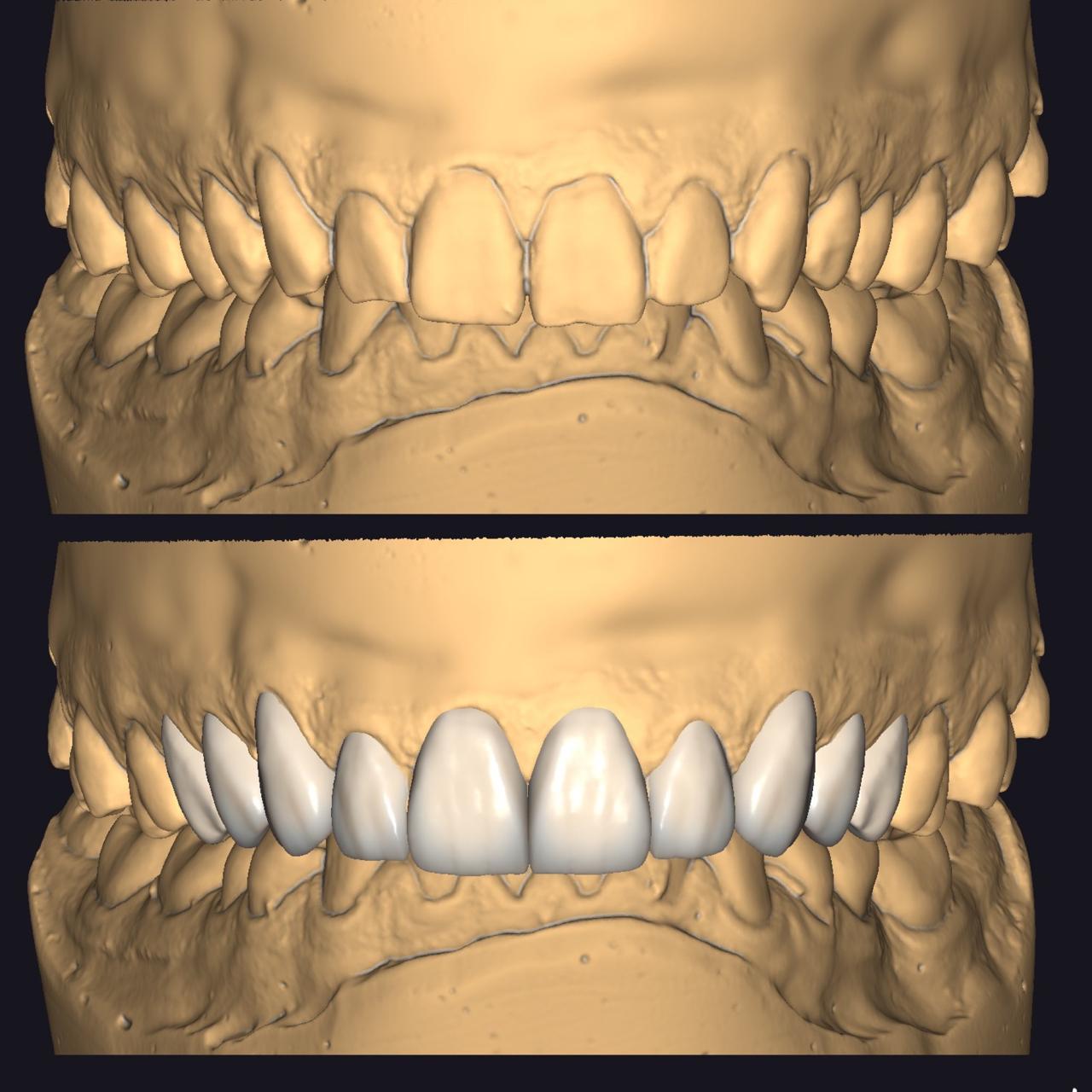Planejamento digital do sorriso na tela do computador